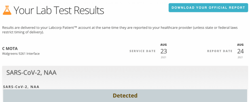 COVID-19 Labcorp test results